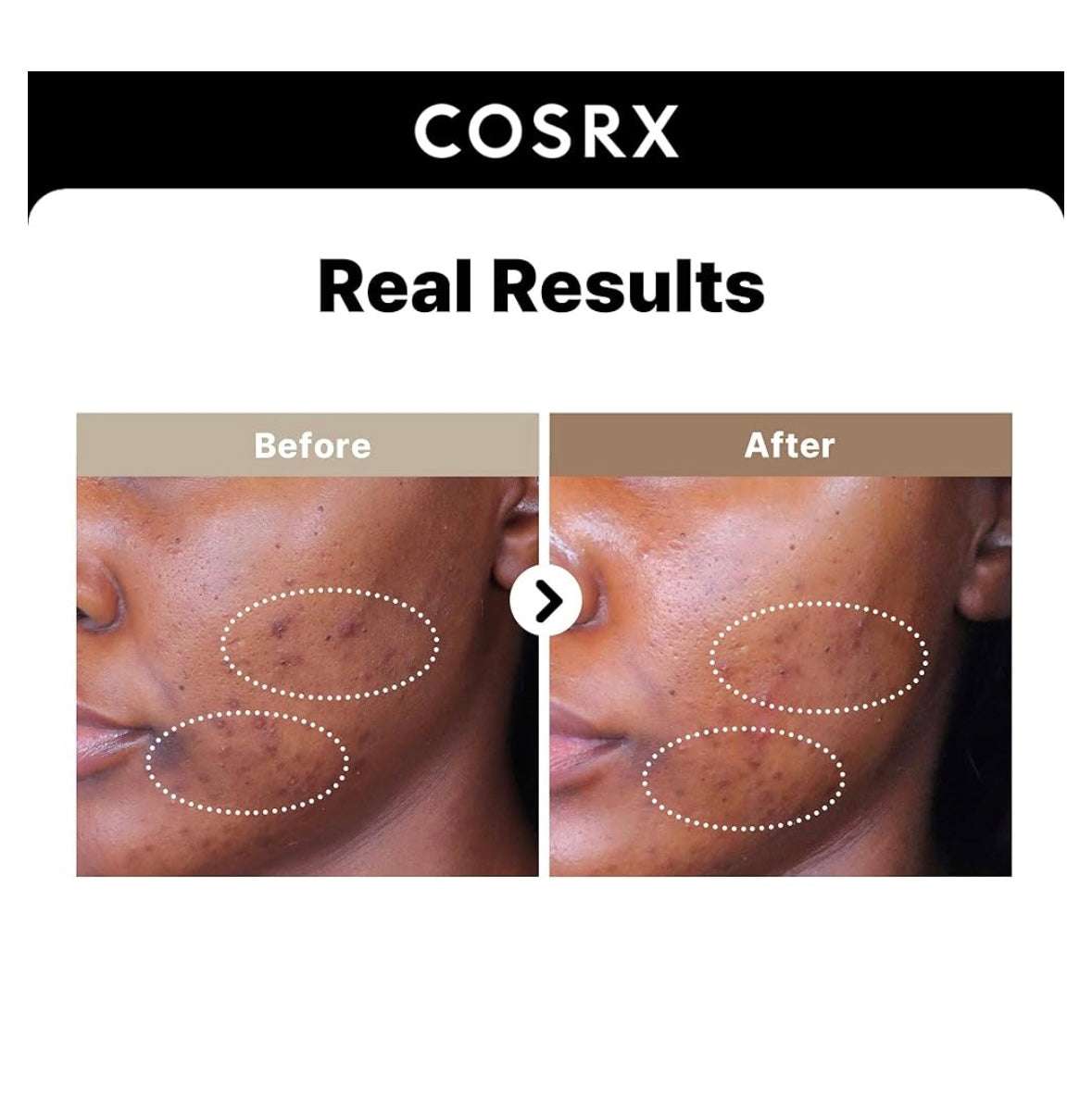 Cosrx Alpha-Arbutin 2 Discoloration Care Serum - 50ml - Sapphire Beauty Booth